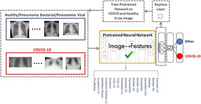 The Performance of Deep Neural Networks in Differentiating Chest X-Rays of COVID-19 Patients From Other Bacterial and Viral Pneumonias